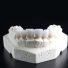 dental Implant treatment in India