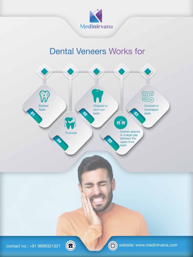 dental-veneers-in-india