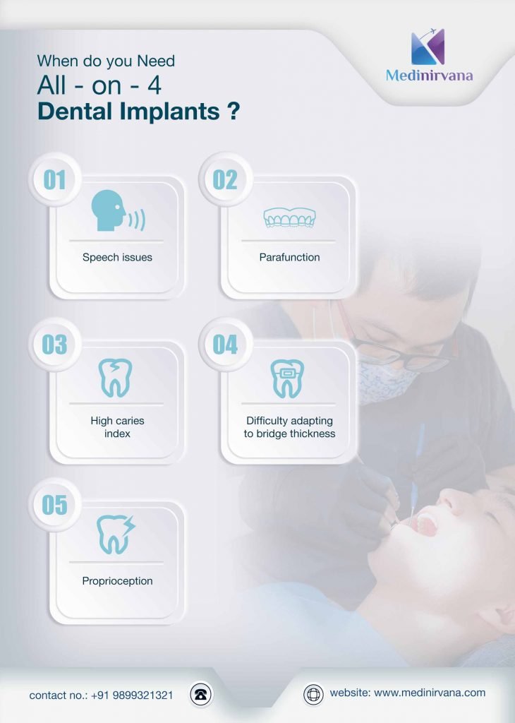 Dental Implants