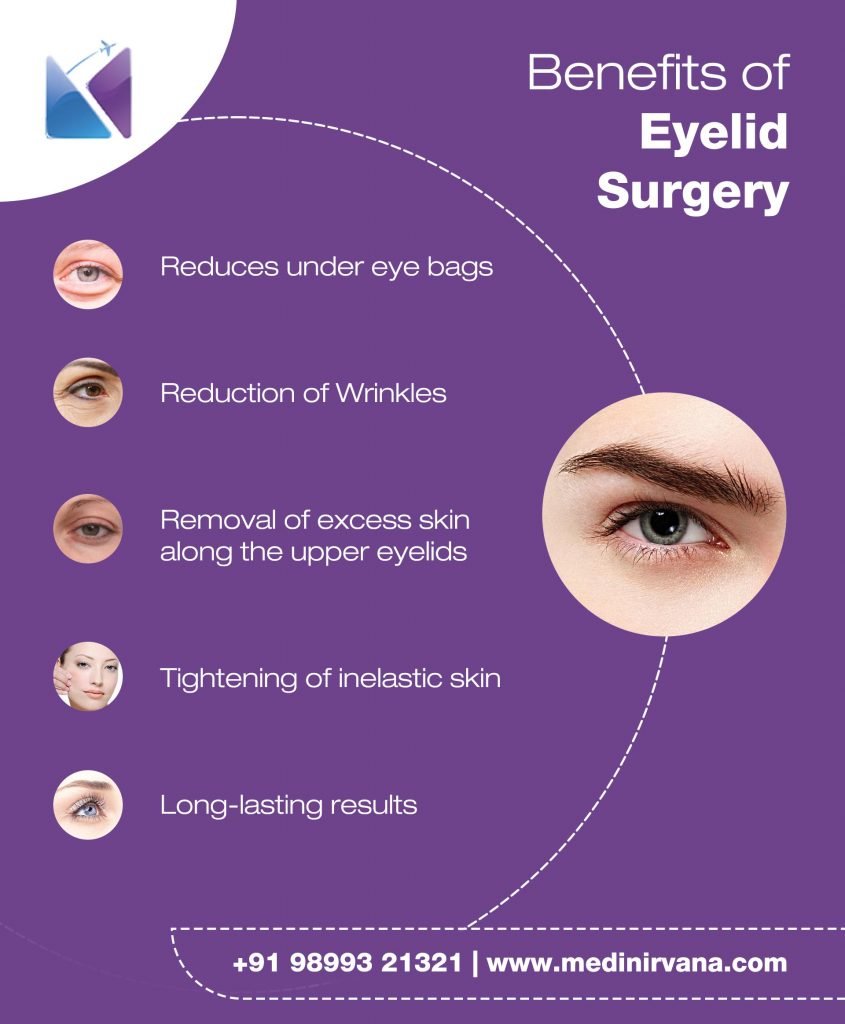 Eyelid Surgery