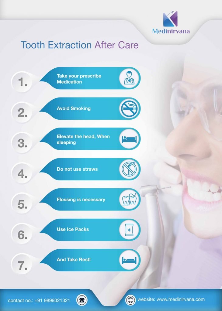 Tooth Extraction