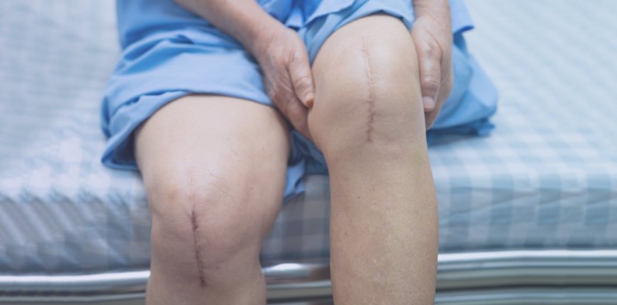 knee-replacement-surgery-india