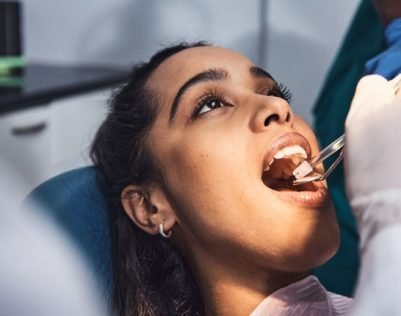 Know if you need a root canal treatment