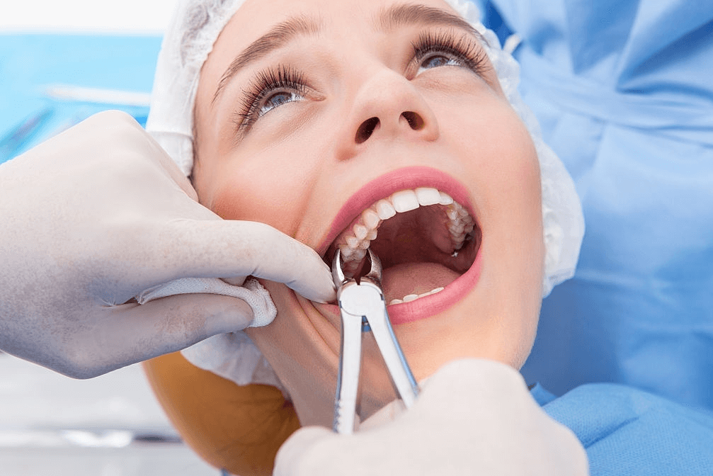 best Tooth Extraction Sheet in india