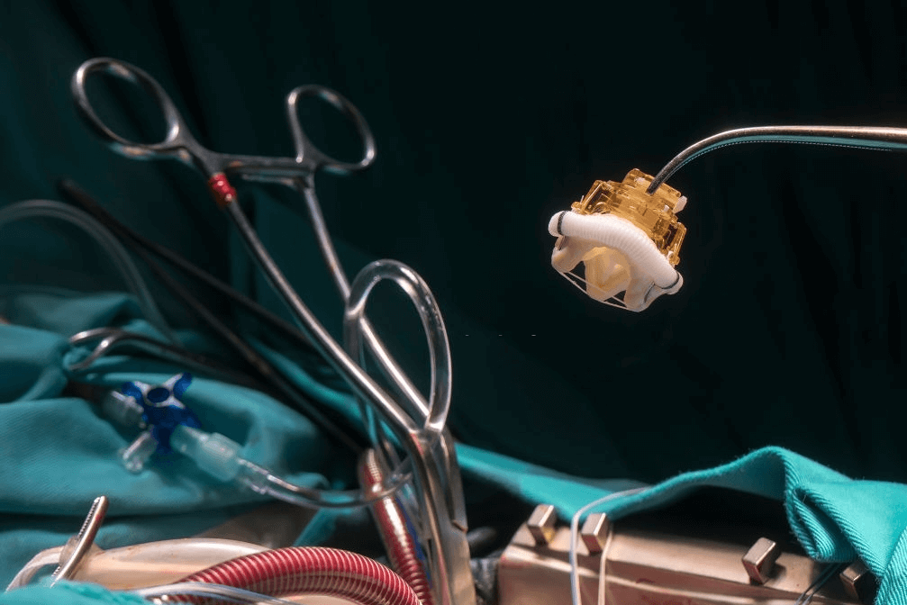 best Heart Valve Replacement Surgery in india