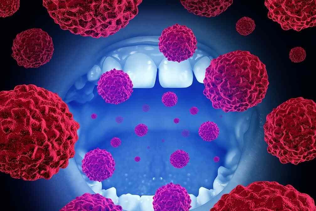 Best Oral Cancer Treatment Cost In India Average Cost