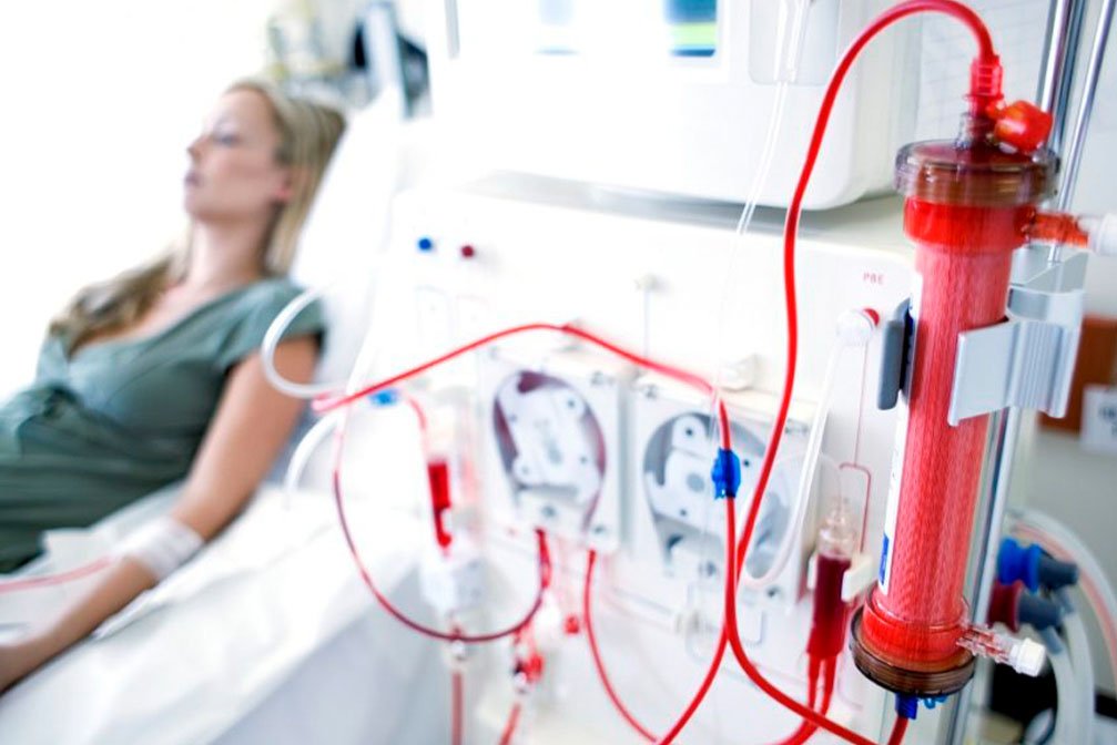 best Hemodialysis in india